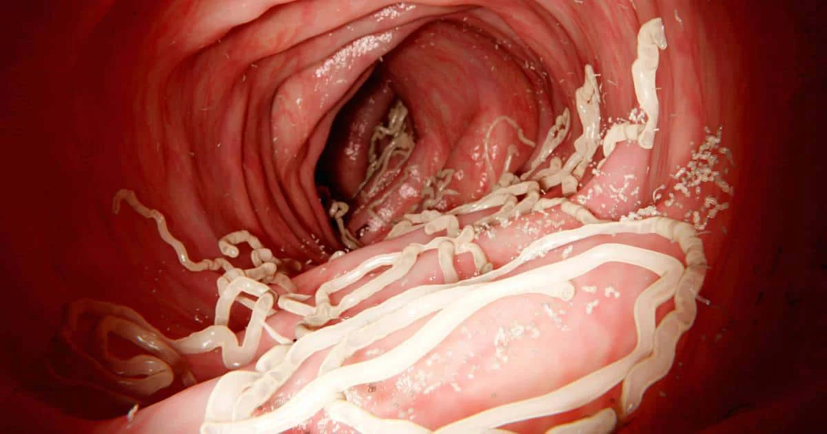 3 main types of parasites that infect humans