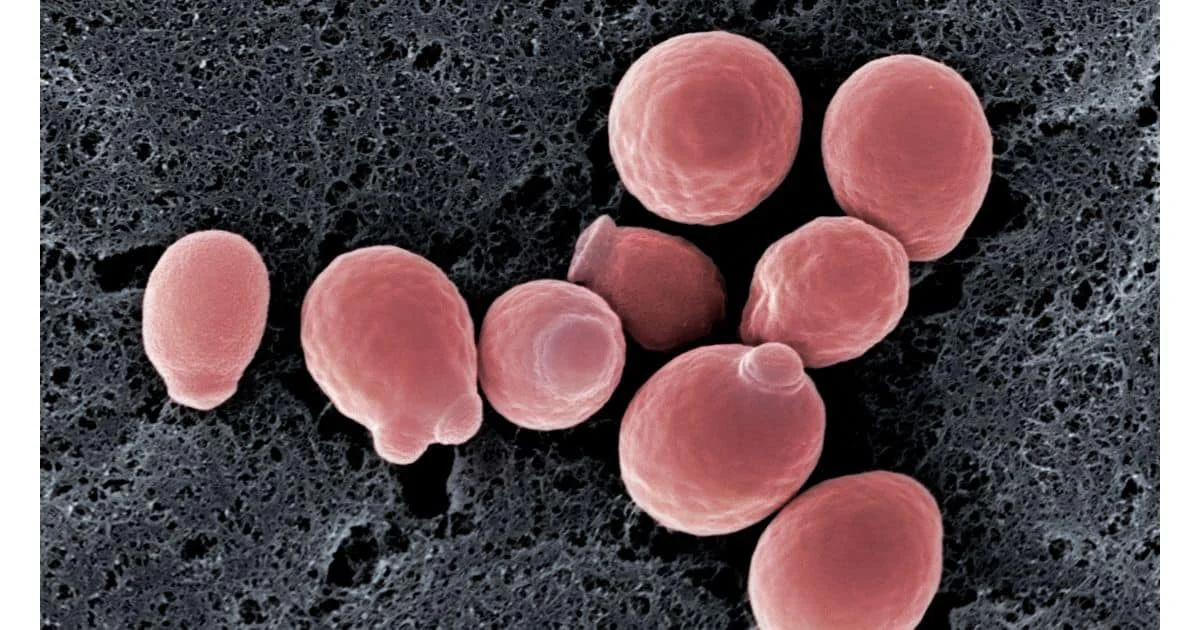 what is candida overgrowth